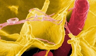 Σημάδια παρασίτων στο ανθρώπινο σώμα