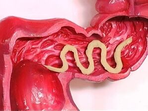 Παράσιτα στο ανθρώπινο σώμα, γιατί εμφανίζονται