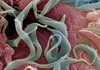 Τα συμπτώματα και η θεραπεία των παρασίτων στο ανθρώπινο σώμα