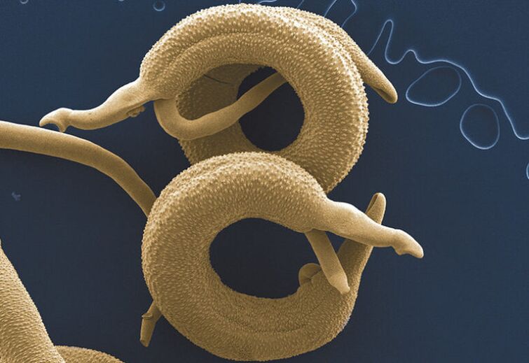 Παράσιτα που ζουν στο ανθρώπινο σώμα