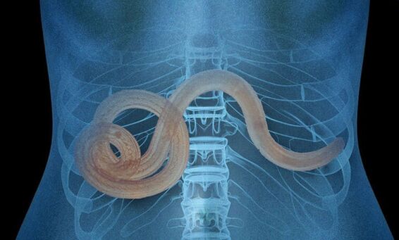 Παράσιτο στο ανθρώπινο σώμα